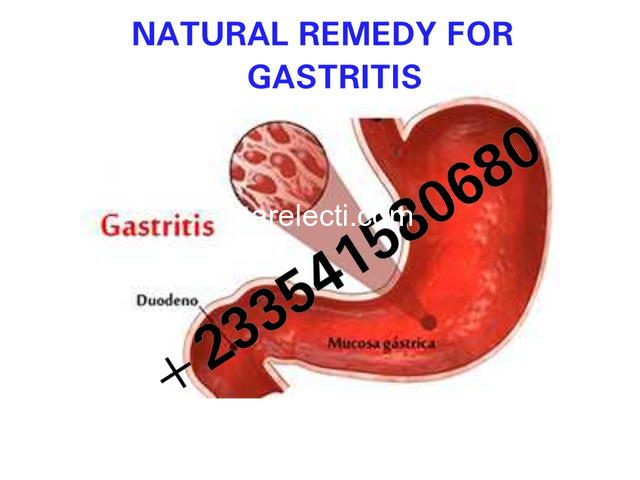 NATURAL TREATMENT FOR GASTRITIS IN GHANA - 1/1