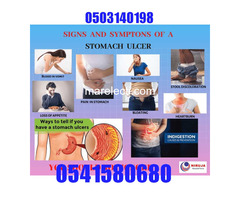 NATURAL TREATMENT FOR PEPTIC ULCER IN GHANA